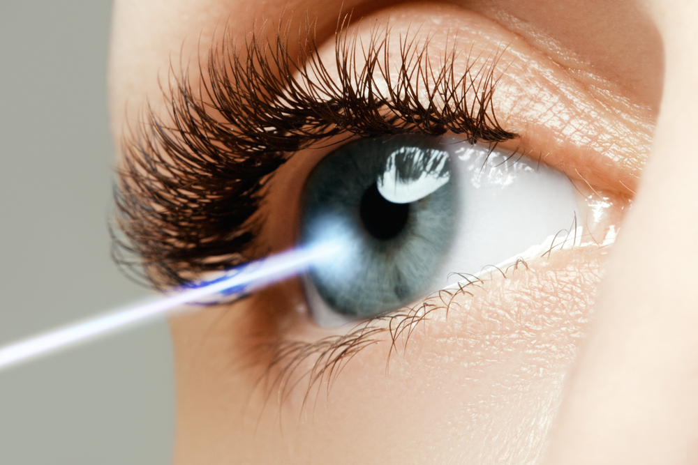 LASIK and Cataract Co-Management